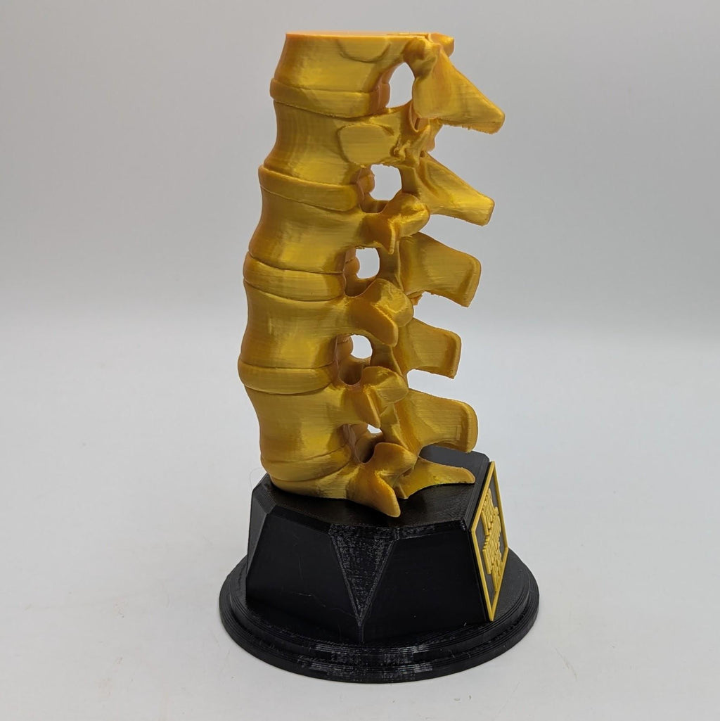 Personalised Spine Trophy, Spinal Column Trophy, Doctor Trophy Award, Back Bone Award, Back Trophy, Custom Trophy Award, Back Spine Award
