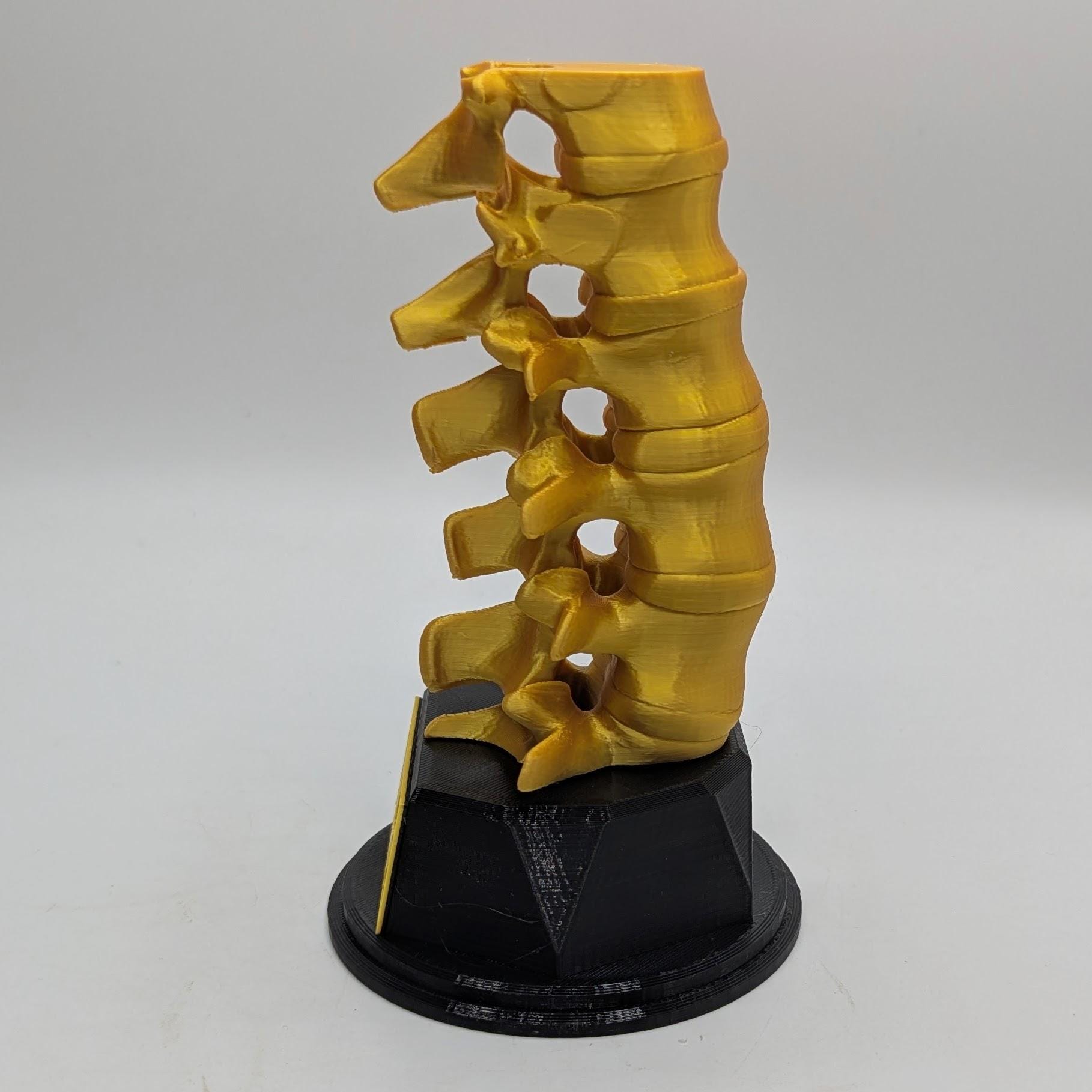 Personalised Spine Trophy, Spinal Column Trophy, Doctor Trophy Award, Back Bone Award, Back Trophy, Custom Trophy Award, Back Spine Award