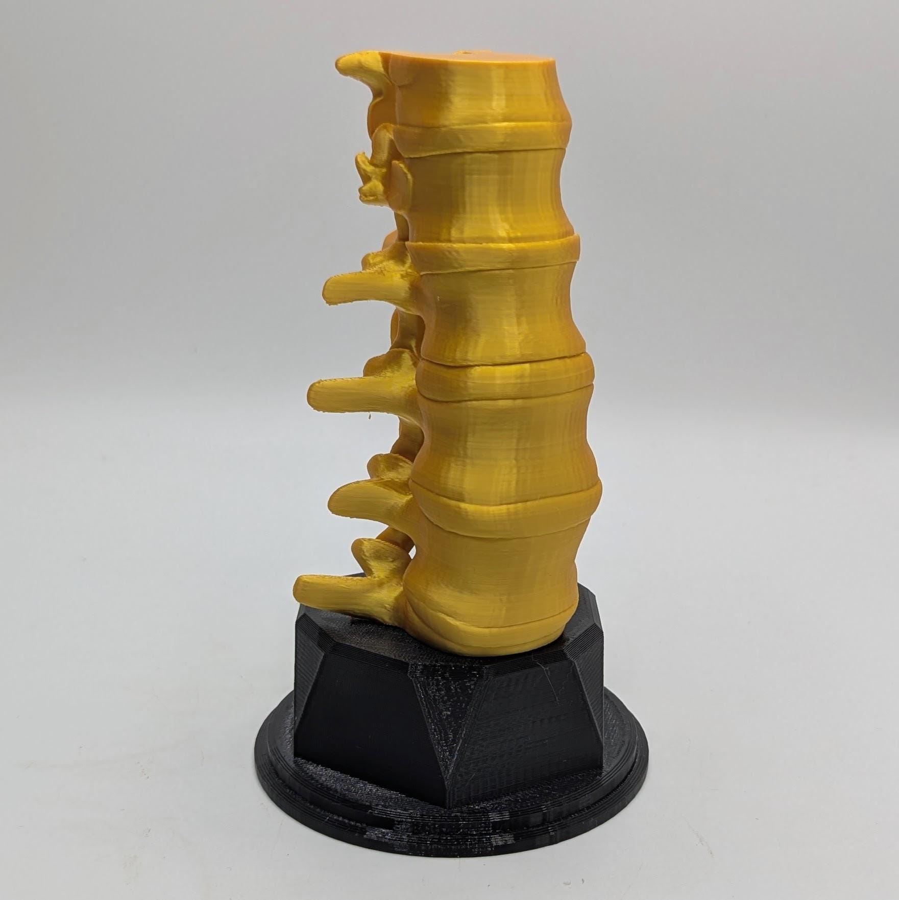 Personalised Spine Trophy, Spinal Column Trophy, Doctor Trophy Award, Back Bone Award, Back Trophy, Custom Trophy Award, Back Spine Award