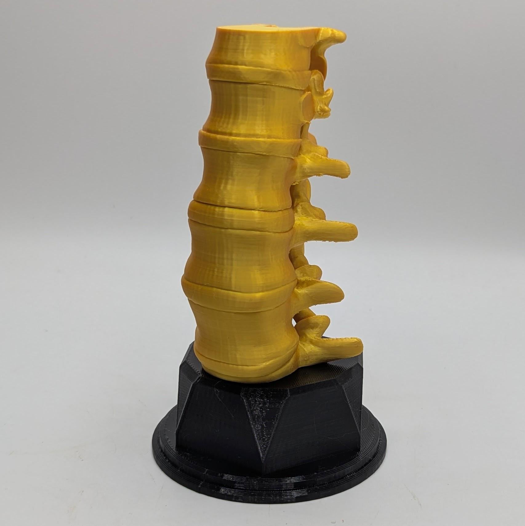 Personalised Spine Trophy, Spinal Column Trophy, Doctor Trophy Award, Back Bone Award, Back Trophy, Custom Trophy Award, Back Spine Award